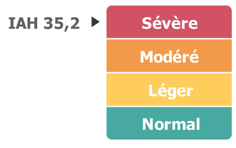 Polygraphie du sommeil