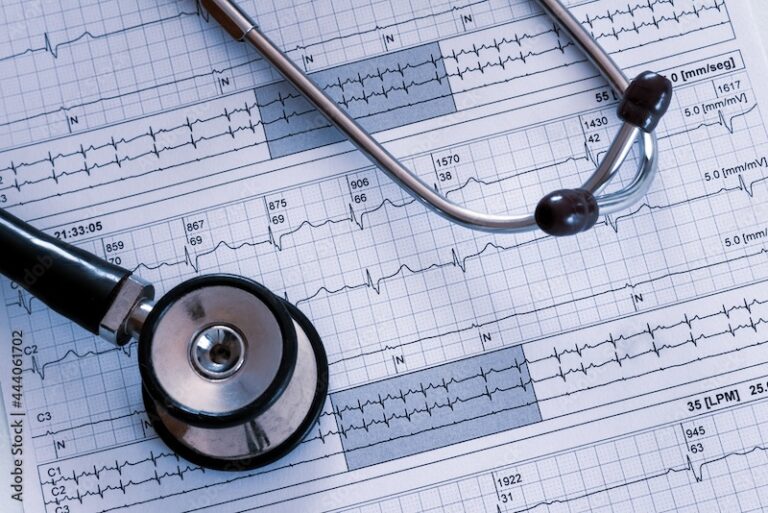 Consultation de rythmologie